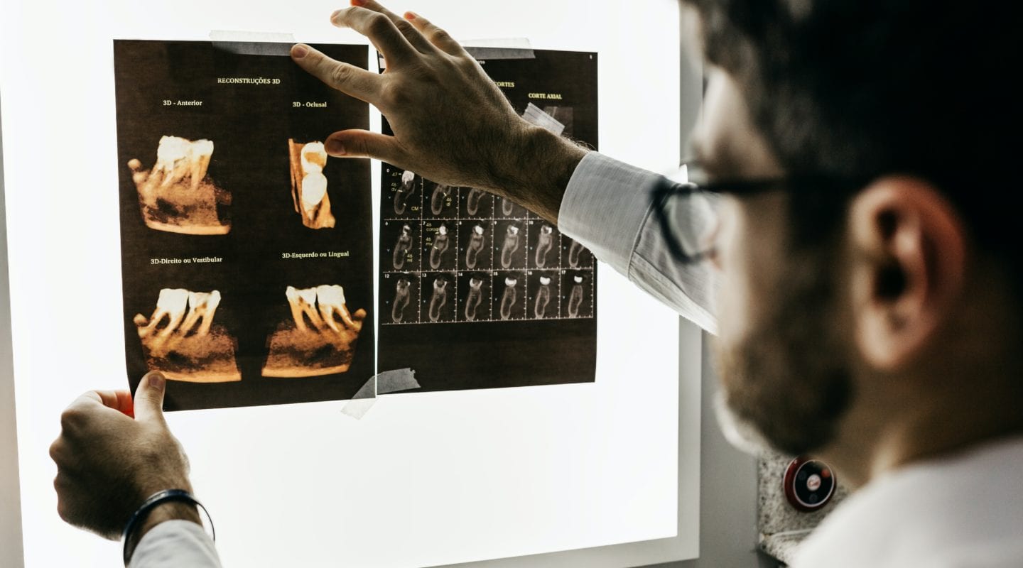 Male dentist with beard and glasses looking at x-rays of teeth